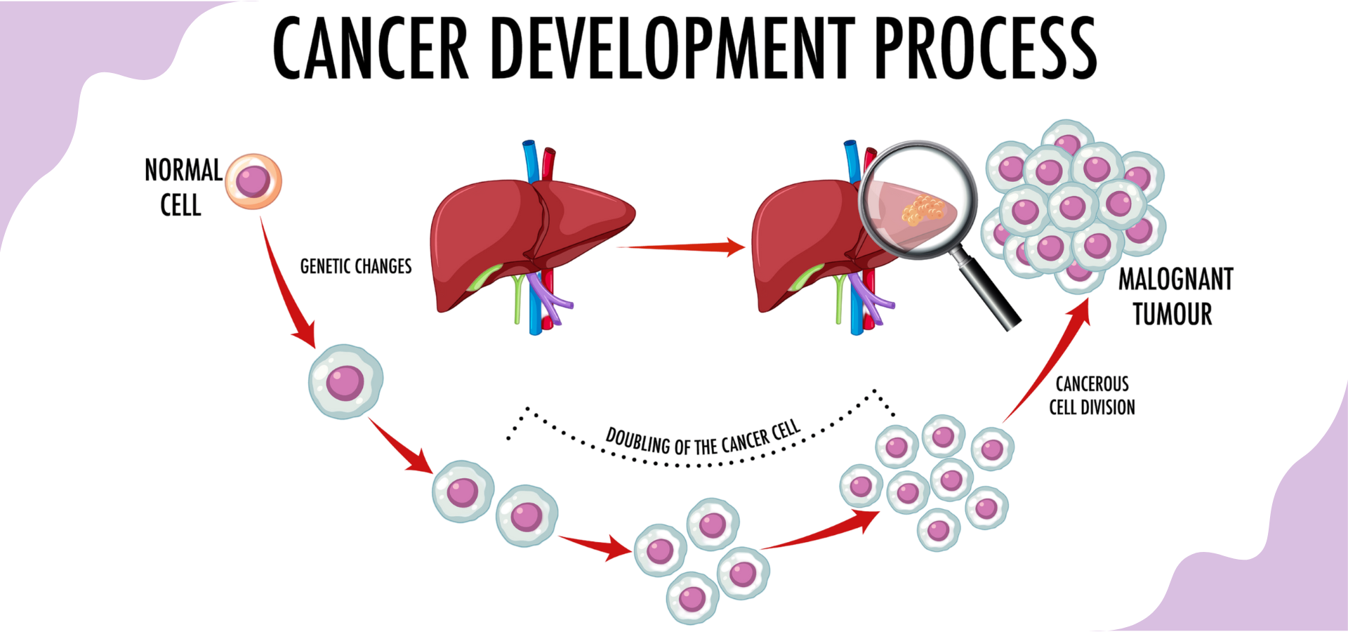 Liver Cancer